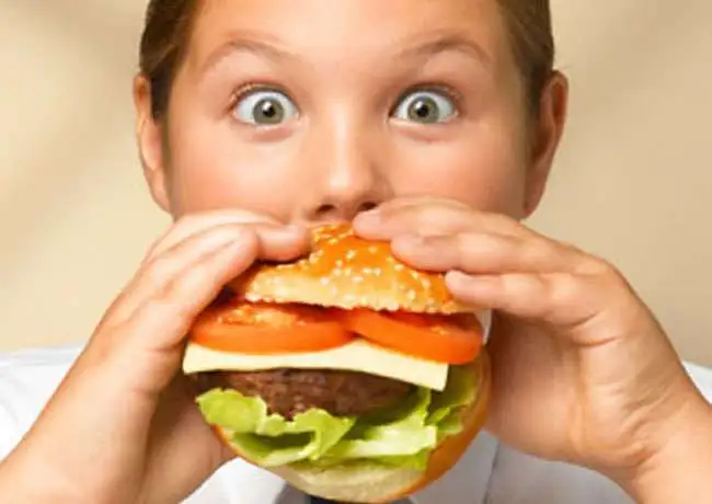 Obesidade Infantil – Fundamentos Essenciais